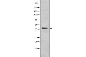 Western blot analysis of TMEFF2 using RAW264. (TMEFF2 Antikörper  (C-Term))