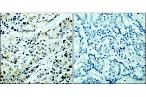 Immunohistochemistry (IHC) image for anti-Histone Deacetylase 5 (HDAC5) (pSer498) antibody (ABIN2888430) (HDAC5 Antikörper  (pSer498))