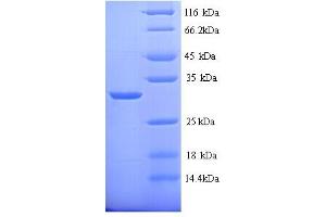SDS-PAGE (SDS) image for Cytochrome P450, Family 21, Subfamily A, Polypeptide 2 (CYP21A2) (AA 2-261) protein (His tag) (ABIN5713302)