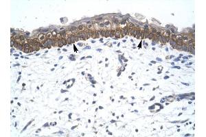 ZNF385 antibody was used for immunohistochemistry at a concentration of 4-8 ug/ml to stain Epidermal cells (arrows) in Human Skin.