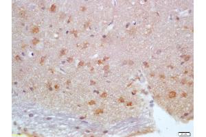 Formalin-fixed and paraffin embedded rat brain labeled with Anti-Calbindin/Calbindin D28k Polyclonal Antibody, Unconjugated (ABIN703691) at 1:200 followed by conjugation to the secondary antibody and DAB staining (CALB1 Antikörper)