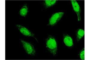 Immunofluorescence of monoclonal antibody to C18orf23 on HeLa cell. (C18orf23 Antikörper  (AA 122-220))