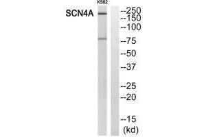 Western blot analysis of extracts from K562 cells, using SCN4A antibody. (SCN4A Antikörper)
