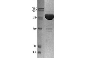 Western Blotting (WB) image for Matrix Metallopeptidase 1 (Interstitial Collagenase) (MMP1) (Transcript Variant 1) protein (His tag) (ABIN2726135)