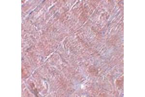 Immunohistochemistry staining in human skeletal muscle tissue with RANBP10 Antibody  at 5 μg/ml. (RANBP10 Antikörper  (Center))
