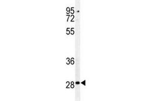 Western Blotting (WB) image for anti-Caspase 3 (CASP3) (AA 149-179) antibody (ABIN3030296)