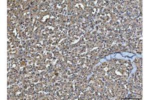 IHC analysis of HMGCR using anti-HMGCR antibody (ABIN7600989). (HMGCR Antikörper  (AA 268-842))