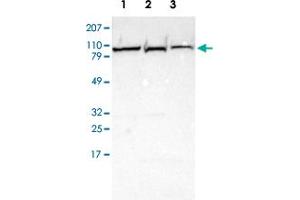 Western blot analysis of Lane 1: Human cell line RT-4 Lane 2: Human cell line EFO-21 Lane 3: Human cell line A-431 with PYGL polyclonal antibody  at 1:250-1:500 dilution. (PYGL Antikörper)