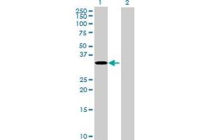 Western Blot analysis of RPUSD1 expression in transfected 293T cell line by RPUSD1 MaxPab polyclonal antibody. (RPUSD1 Antikörper  (AA 1-312))