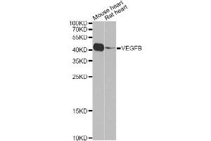 Western blot analysis of extracts of various cell lines, using VEGFB Antibody (ABIN5971159) at 1/1000 dilution. (VEGFB Antikörper)