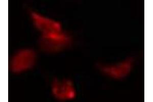 ABIN6274619 staining 293 cells by IF/ICC. (CDK5RAP3 Antikörper)