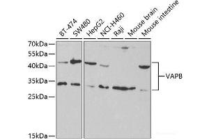 Western blot analysis of extracts of various cell lines using VAPB Polyclonal Antibody at dilution of 1:1000. (VAPB Antikörper)