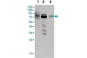 Western blot analysis using MDM4 monoclonal antobody, clone 2D10F4  against HeLa (1), A-549 (2) and A-431 (3) cell lysate. (MDM4-binding Protein Antikörper)