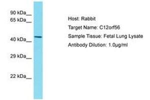Image no. 1 for anti-Chromosome 12 Open Reading Frame 56 (C12ORF56) (AA 77-126) antibody (ABIN6750551) (C12orf56 Antikörper  (AA 77-126))