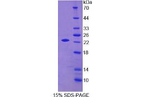 Image no. 1 for Apolipoprotein O (APOO) (AA 26-198) protein (His tag) (ABIN6237004)
