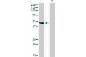 Western Blotting (WB) image for anti-Twinfilin, Actin-Binding Protein 1 (TWF1) (AA 80-252) antibody (ABIN562524)