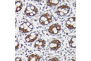 Immunohistochemistry of paraffin-embedded human colon using Monoamine Oxidase B (MAOB) Rabbit pAb (ABIN3022151, ABIN3022152, ABIN3022153, ABIN1513172 and ABIN6218632) at dilution of 1:150 (40x lens). (Monoamine Oxidase B Antikörper  (AA 1-260))