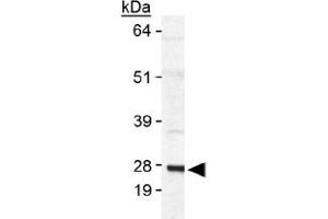 Western blot analysis of SAT1 in human SAT1 transfected lysate using with SAT1 polyclonal antibody . (SAT1 Antikörper  (AA 100-171))