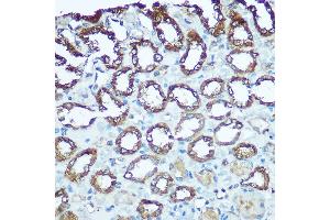 Immunohistochemistry of paraffin-embedded rat kidney using UQCRFS1 Rabbit pAb (ABIN6131106, ABIN6149963, ABIN6149965 and ABIN6222528) at dilution of 1:100 (40x lens).