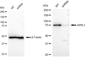 Western blotting analysis using APPL1 antibody (ABIN7797507).