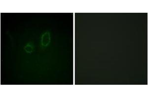 Immunofluorescence analysis of A549 cells, using Moesin/Ezrin/Radixin (Phospho-Thr558) Antibody. (Moesin/ezrin/radixin (AA 524-573), (pThr558) Antikörper)