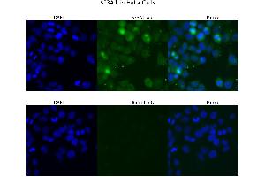 Sample Type :  HeLa   Primary Antibody Dilution:  4 ug/ml   Secondary Antibody :  Anti-rabbit Alexa 546   Secondary Antibody Dilution:  2 ug/ml   Gene Name :  SF3A1 (SF3A1 Antikörper  (N-Term))