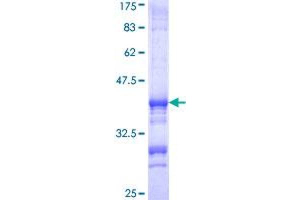 ATP6V1E1 Protein (AA 136-226) (GST tag)