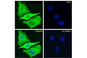 Immunofluoresence staining of fixed HeLa cells with anti-Beta-tubulin antibody S11B. (Rekombinanter TUBB Antikörper)