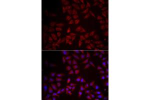 Immunofluorescence analysis of HeLa cell using CCL25 antibody.
