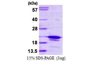 SDS-PAGE (SDS) image for SYF2 Homolog, RNA Splicing Factor (SYF2) (AA 94-243) protein (His tag) (ABIN6386826)