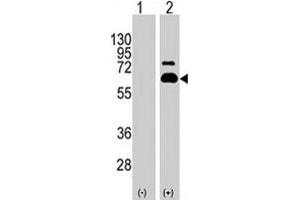 Western blot analysis of RPS6KB1 (arrow) using RPS6KB1 polyclonal antibody . (RPS6KB1 Antikörper  (Ser404))