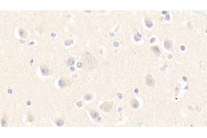 Immunohistochemistry (IHC) image for anti-Mannose Phosphate Isomerase (MPI) (AA 2-423) antibody (ABIN7441487)