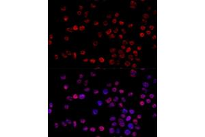 Immunofluorescence analysis of 293T cells using HNRNPH1 Polyclonal Antibody (ABIN6133752, ABIN6141911, ABIN6141912 and ABIN7101789) at dilution of 1:100 (40x lens). (HNRNPH1 Antikörper)