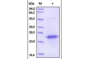 Human VEGF165 Protein, His Tag on SDS-PAGE under reducing (R) and no-reducing (NR) conditions.