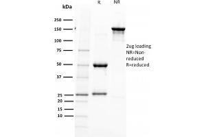 SDS-PAGE Analysis Purified PAX5 Mouse Monoclonal Antibody (PAX5/2595). (PAX5 Antikörper)