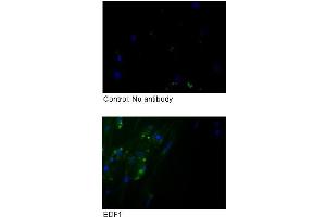 Sample Type :  Fibroblasts (EDF1 Antikörper  (Middle Region))