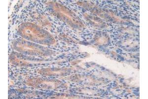 IHC-P analysis of Mouse Intestine Tissue, with DAB staining. (WARS Antikörper  (AA 29-195))