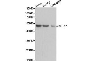 Western blot analysis of extracts of various cell lines, using KRT17 antibody. (KRT17 Antikörper  (AA 133-432))