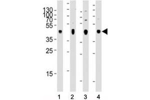 Western blot analysis of lysate from 1) human skeletal muscle, 2) human brain, 3) mouse brain, and 4) rat brain tissue using PDK2 antibody at 1:2000 for each lane. (PDK2 Antikörper)