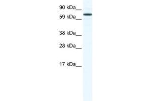 WB Suggested Anti-FOXO6 Antibody Titration:  1. (Foxo6 Antikörper  (N-Term))