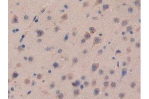 Detection of CDH16 in Mouse Brain Tissue using Polyclonal Antibody to Cadherin 16 (CDH16) (Cadherin-16 Antikörper  (AA 353-617))