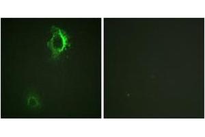 Immunofluorescence analysis of HepG2 cells, using CD5 (Phospho-Tyr453) Antibody. (CD5 Antikörper  (pTyr453))
