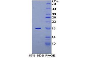SDS-PAGE (SDS) image for Progesterone Receptor (PGR) (AA 672-790) protein (His tag) (ABIN2126412)