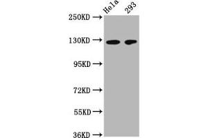 Western Blot Positive WB detected in: Hela whole cell lysate, 293 whole cell lysate All lanes: CD146 antibody at 1:500 Secondary Goat polyclonal to Mouse IgG at 1/50000 dilution Predicted band size: 72, 58 kDa Observed band size: 120 kDa (MCAM Antikörper  (AA 50-646))