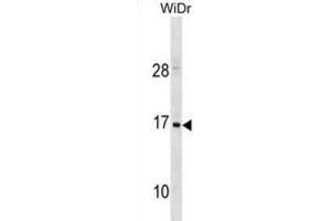 Western Blotting (WB) image for anti-Hemoglobin, zeta (HBZ) antibody (ABIN3001037)