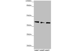 Western blot All lanes: DYNC2LI1 antibody at 1. (DYNC2LI1 Antikörper  (AA 1-352))
