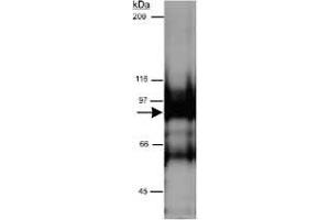 Western blot analysis of CYTSB in HeLa whole cell lysate (RIPA) using CYTSB polyclonal antibody  at 0. (NSP5 Antikörper  (AA 200-300))