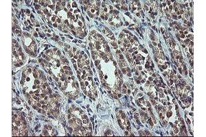 Image no. 1 for anti-Cyclin-Dependent Kinase Inhibitor 2B (p15, Inhibits CDK4) (CDKN2B) antibody (ABIN1497445) (CDKN2B Antikörper)
