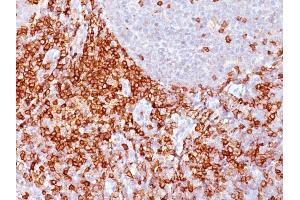 Formalin-fixed, paraffin-embedded human Spleen stained with CD43 Mouse Monoclonal Antibody (Bra7G). (CD43 Antikörper)