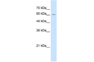 WB Suggested Anti-ZP2 Antibody Titration:  2. (ZP2 Antikörper  (C-Term))